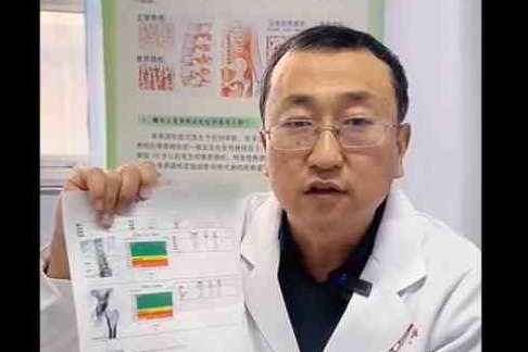 衡水四院科普｜怎么知道我是不是骨质疏松了呢？