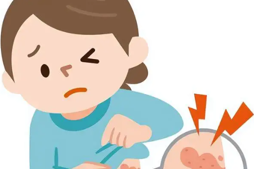 预防带状疱疹，3类高风险人群需警惕